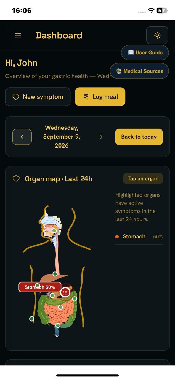 StomachEaser dashboard with organ map and active symptoms